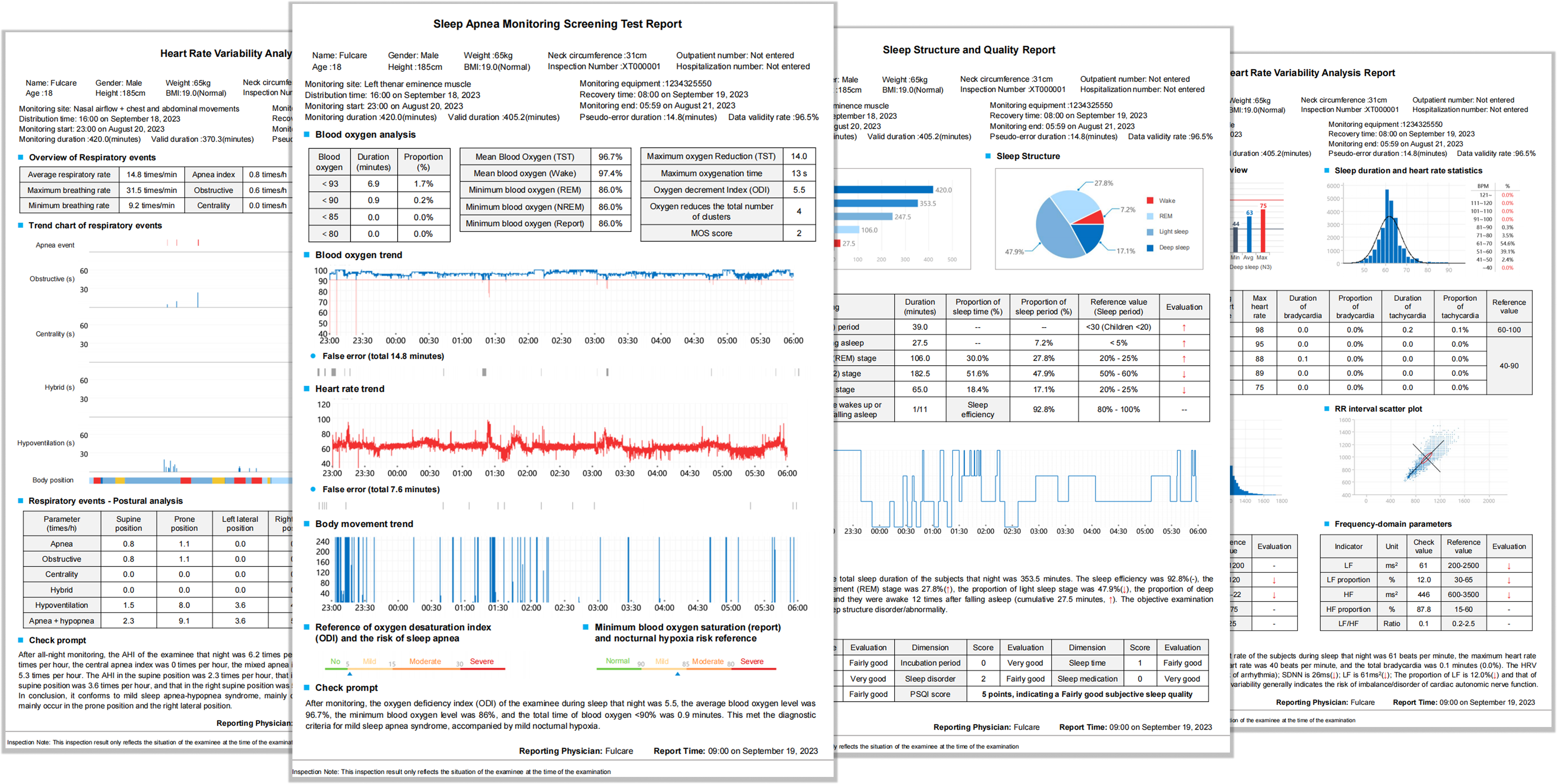Sleep apnea test - report sample